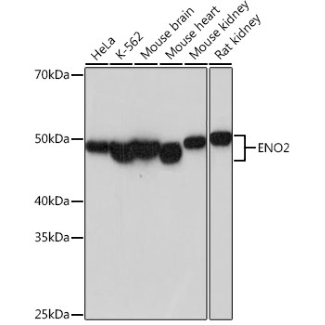 ENO2 Rabbit Monoclonal Antibody