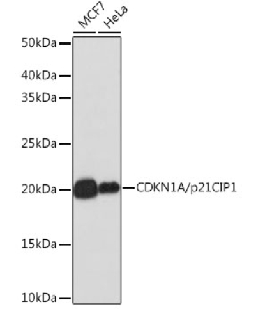 CDKN1A/p21 Rabbit Monoclonal Antibody [KO Validated]
