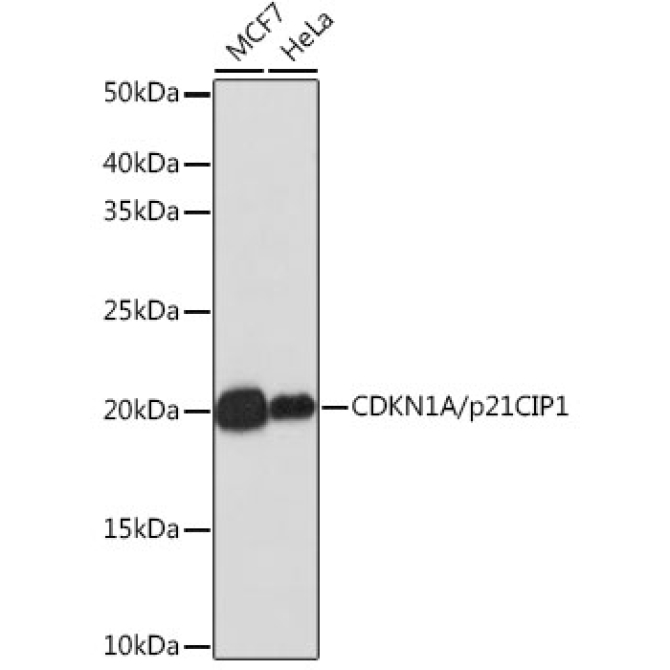 CDKN1A/p21 Rabbit Monoclonal Antibody [KO Validated]