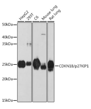 CDKN1B/p27KIP1 Rabbit Monoclonal Antibody