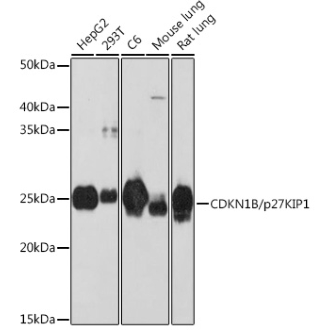 CDKN1B/p27KIP1 Rabbit Monoclonal Antibody