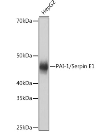 PAI-1/Serpin E1 Rabbit Monoclonal Antibody