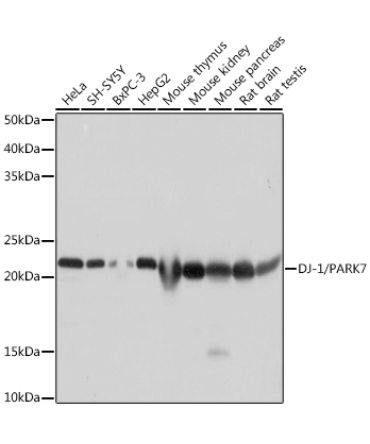 DJ-1/PARK7 Rabbit Monoclonal Antibody