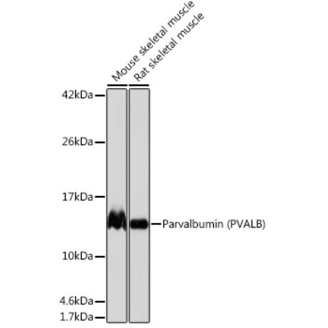 Parvalbumin/PVALB Rabbit Monoclonal Antibody