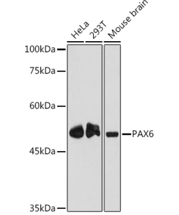 PAX6 Rabbit Monoclonal Antibody