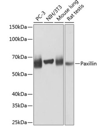 Paxillin Rabbit Monoclonal Antibody