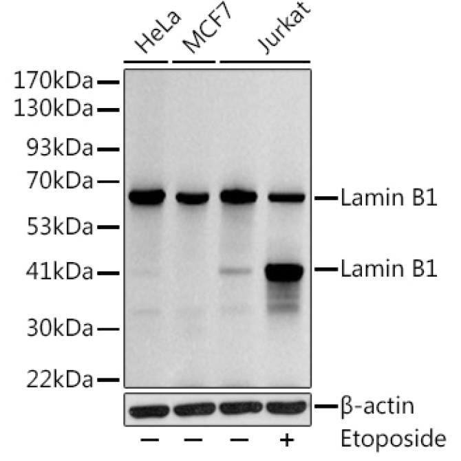 Lamin B1 Rabbit Polyclonal Antibody