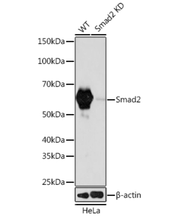 Smad2 Rabbit Monoclonal Antibody [KD Validated]