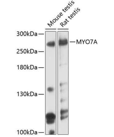 MYO7A Rabbit Polyclonal Antibody
