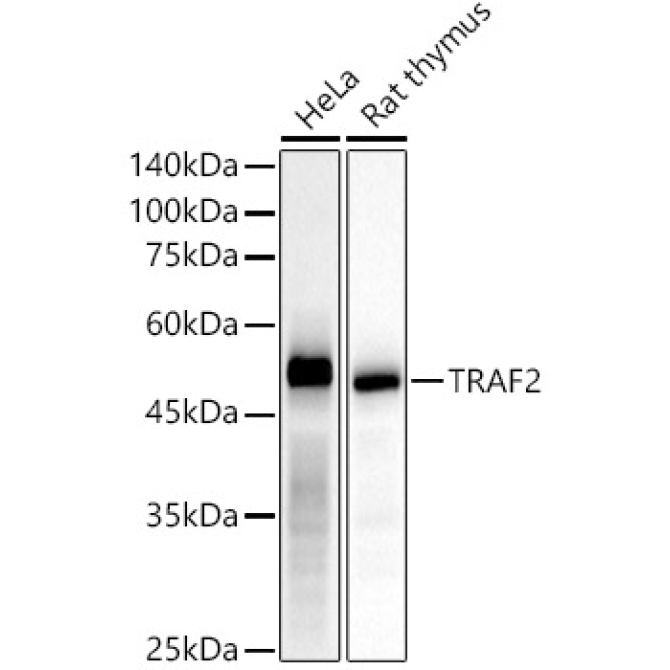 TRAF2 Rabbit Monoclonal Antibody [KD Validated]