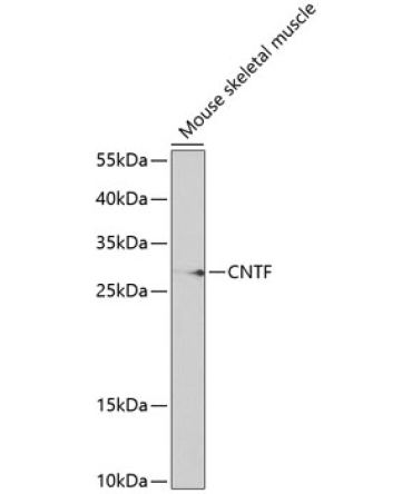 CNTF Rabbit Polyclonal Antibody