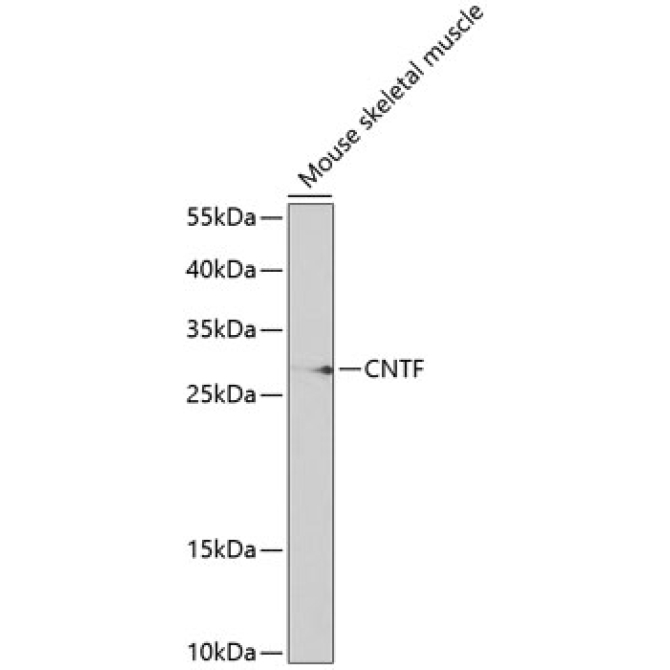 CNTF Rabbit Polyclonal Antibody