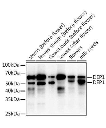 DEP1 Rabbit Polyclonal Antibody