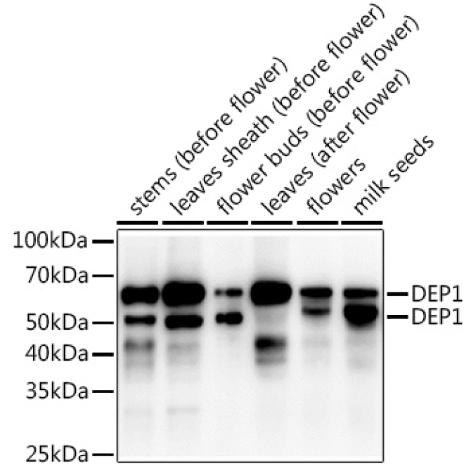 DEP1 Rabbit Polyclonal Antibody