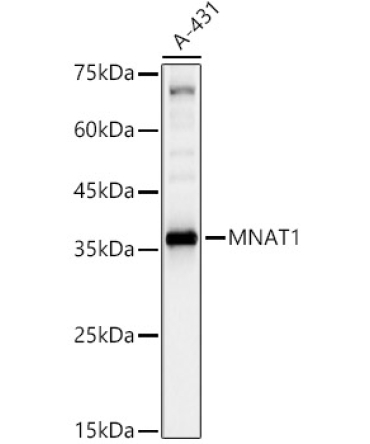 MNAT1 Rabbit Polyclonal Antibody