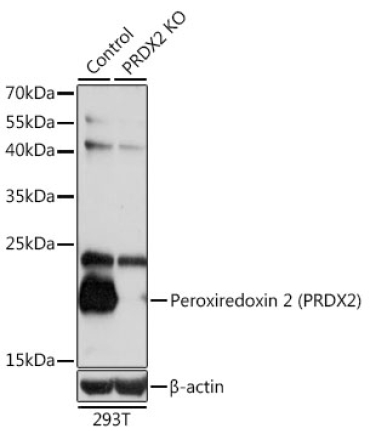 Peroxiredoxin 2 (PRDX2) Rabbit Polyclonal Antibody [KO Validated]