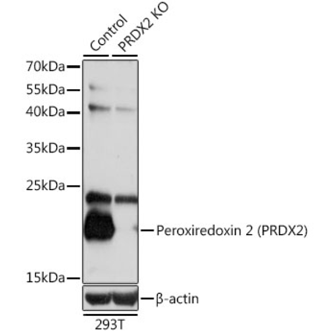 Peroxiredoxin 2 (PRDX2) Rabbit Polyclonal Antibody [KO Validated]