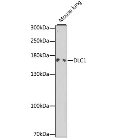 DLC1 Rabbit Polyclonal Antibody
