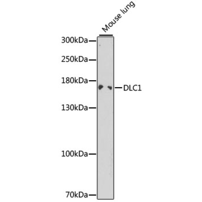DLC1 Rabbit Polyclonal Antibody