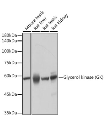 Glycerol kinase (GK) Rabbit Monoclonal Antibody