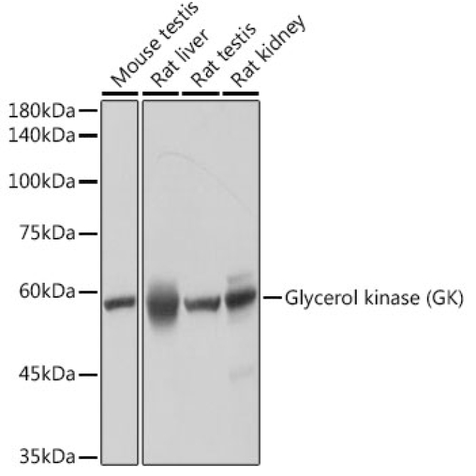 Glycerol kinase (GK) Rabbit Monoclonal Antibody