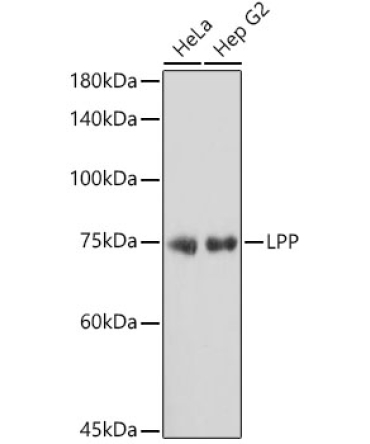 LPP Rabbit Monoclonal Antibody