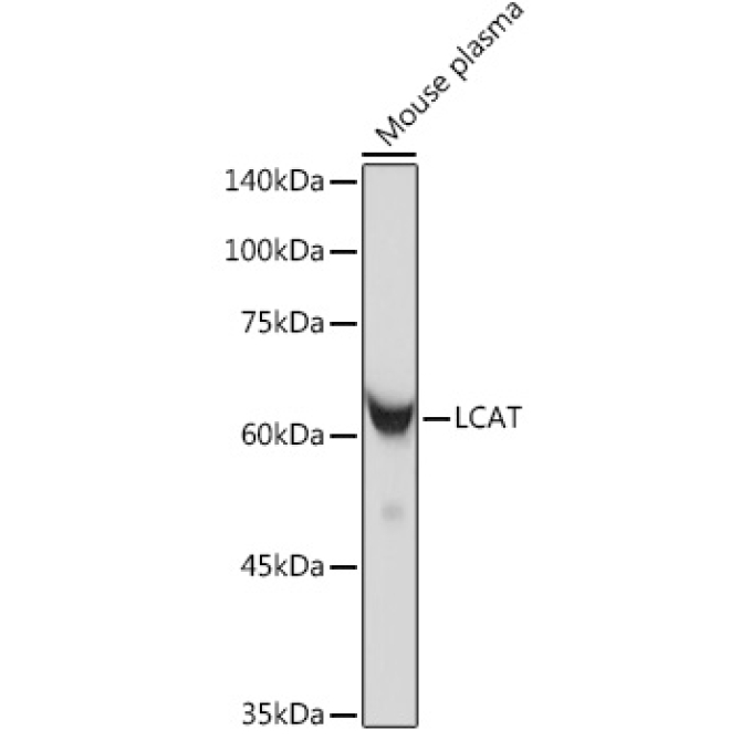 LCAT Rabbit Monoclonal Antibody