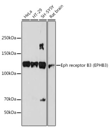 Eph receptor B3 (EPHB3) Rabbit Monoclonal Antibody