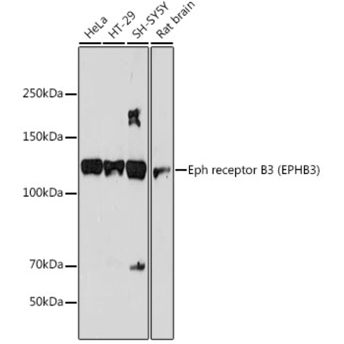 Eph receptor B3 (EPHB3) Rabbit Monoclonal Antibody