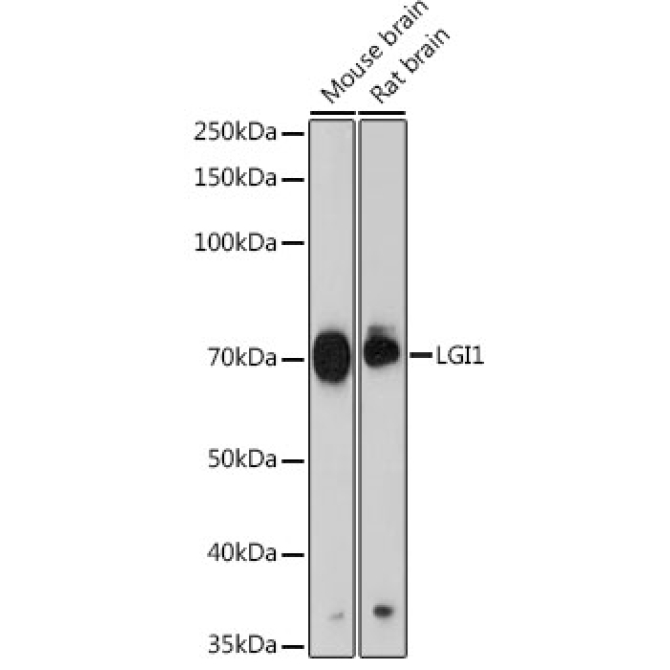LGI1 Rabbit Monoclonal Antibody