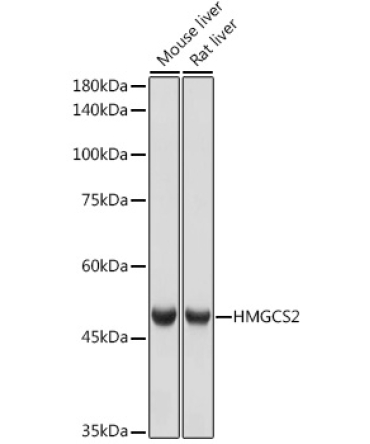 HMGCS2 Rabbit Monoclonal Antibody