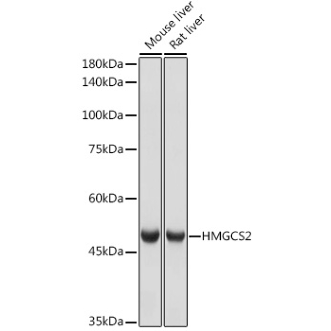 HMGCS2 Rabbit Monoclonal Antibody