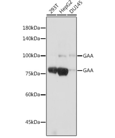 GAA Rabbit Monoclonal Antibody