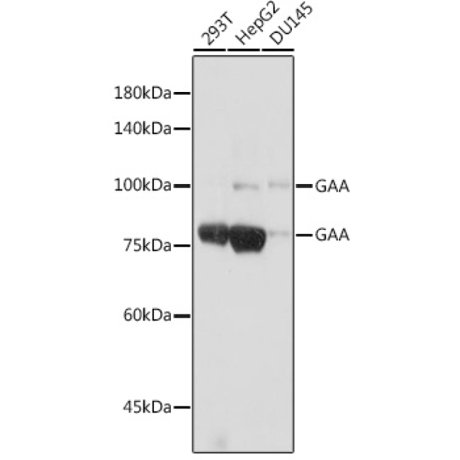 GAA Rabbit Monoclonal Antibody