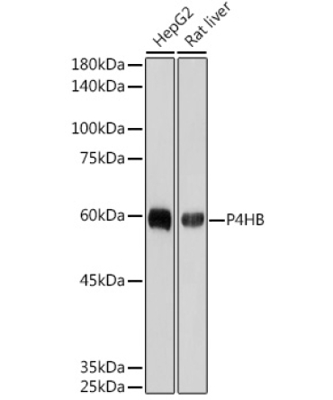 P4HB Rabbit Monoclonal Antibody