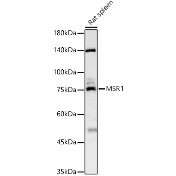 MSR1 Rabbit Polyclonal Antibody