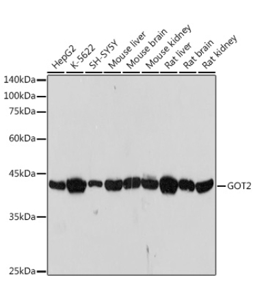 GOT2 Rabbit Monoclonal Antibody