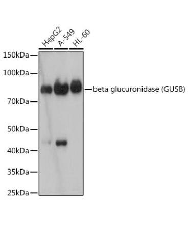 beta glucuronidase (GUSB) Rabbit Monoclonal Antibody