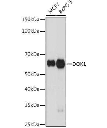 DOK1 Rabbit Monoclonal Antibody