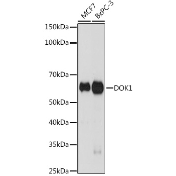 DOK1 Rabbit Monoclonal Antibody