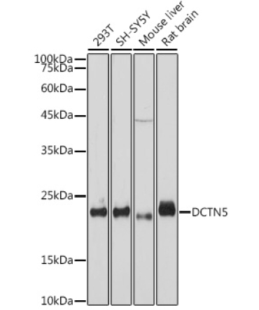 DCTN5 Rabbit Monoclonal Antibody