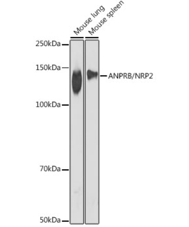ANPRB/NRP2 Rabbit Monoclonal Antibody