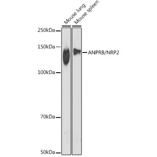 ANPRB/NRP2 Rabbit Monoclonal Antibody
