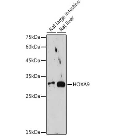HOXA9 Rabbit Monoclonal Antibody