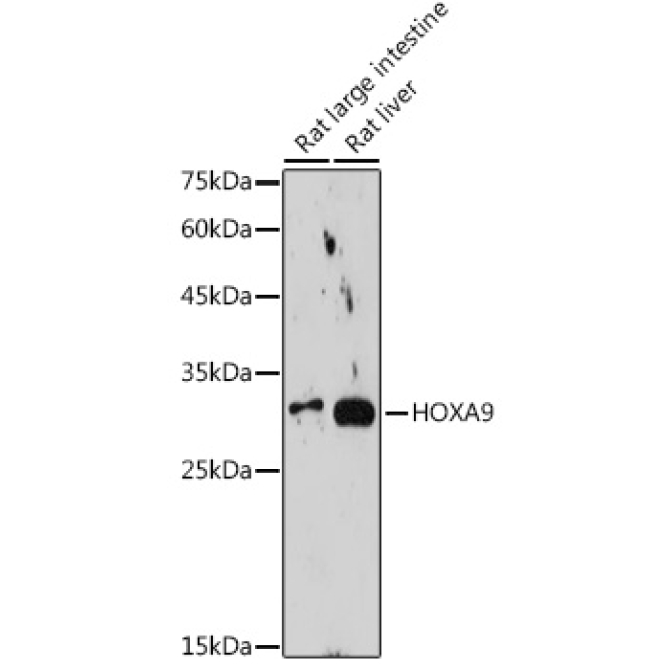 HOXA9 Rabbit Monoclonal Antibody