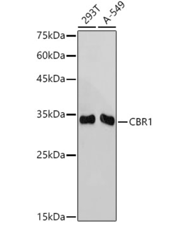 CBR1 Rabbit Monoclonal Antibody