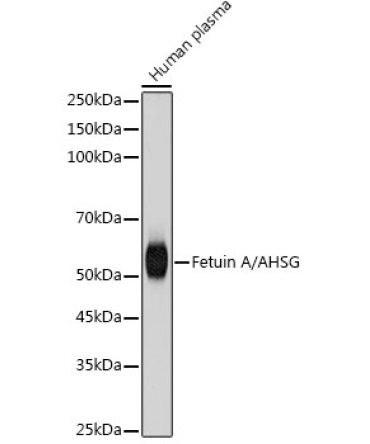 Fetuin A/AHSG Rabbit Monoclonal Antibody