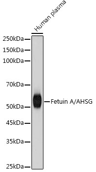 Fetuin A/AHSG Rabbit Monoclonal Antibody
