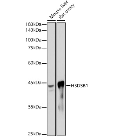 HSD3B1 Rabbit Monoclonal Antibody