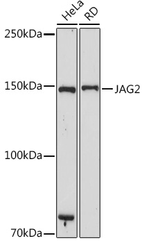 JAG2 Rabbit Monoclonal Antibody